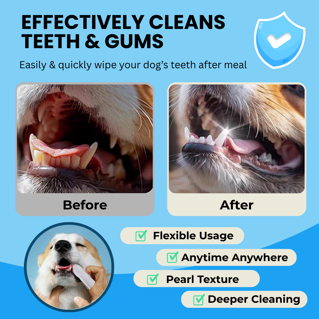 Finger Wipes-Love & Care in Every Wipe