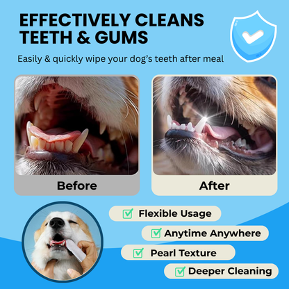 Finger Wipes-Love & Care in Every Wipe